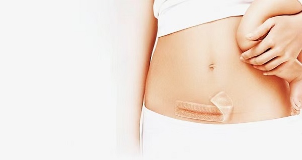 किन बाक्लो सिलिकॉन जेल स्कार पानाहरू यति लोकप्रिय छन्?