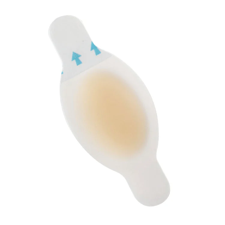 खुट्टाको छालाको रोकथामका लागि पानी प्रतिरोधी हाइड्रोकोलाइड ब्यान्डेज